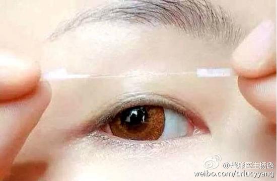 双眼皮贴