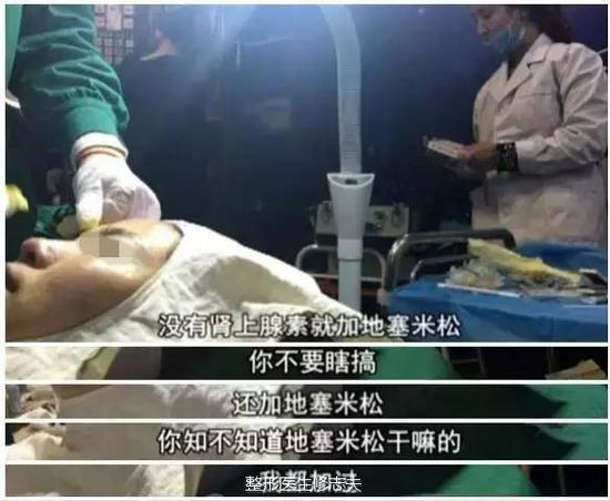 暗访
