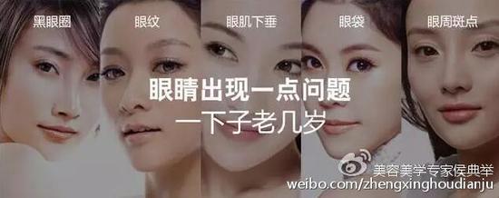 护眼