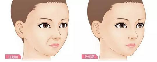 效果