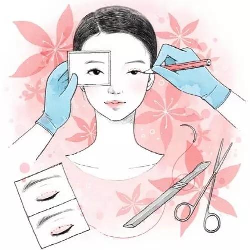 术后拆线是不是很疼啊?