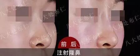 对比