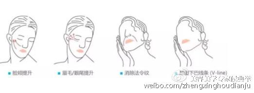 埋蛋白线