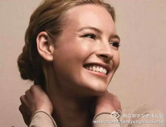 细小皱纹
