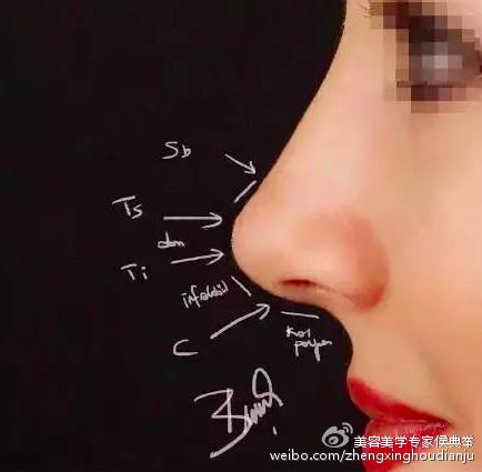 翘而不露鼻孔