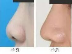 对比