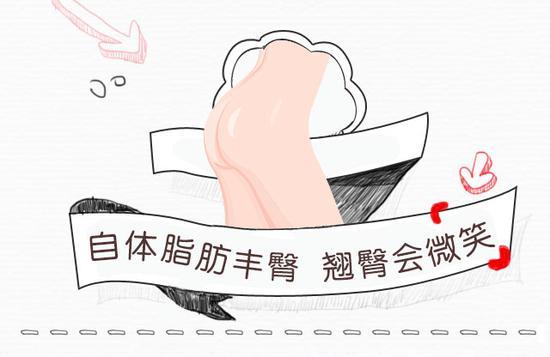自体脂肪丰臀