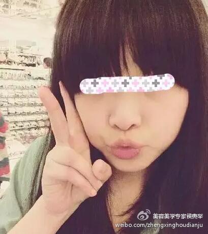 塌鼻子