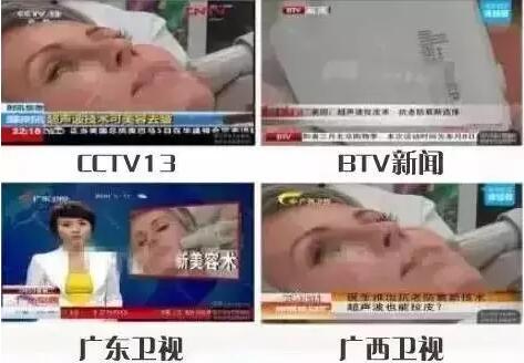 宣传超声刀