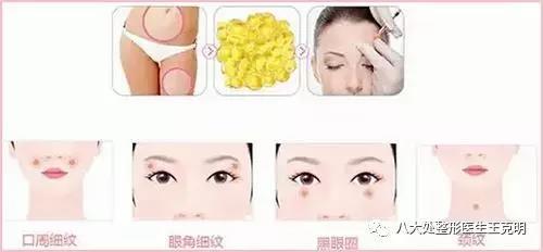 脂肪