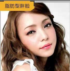 脂肪型