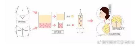 非常高