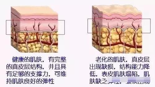 线雕提拉
