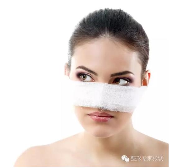 皱纹去除不佳