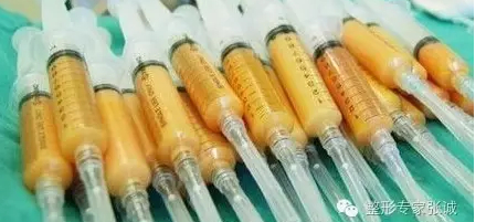 肉毒素配合填充剂效果更好