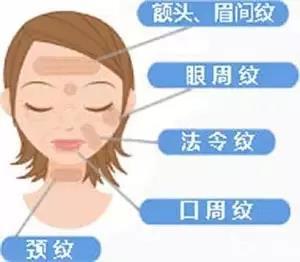 表情纹
