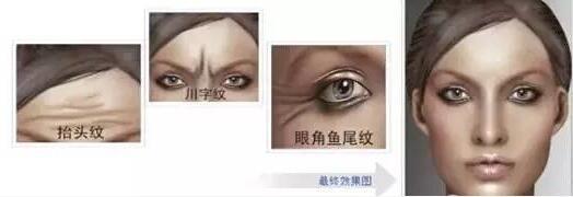 皱纹