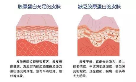 抗老
