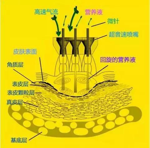 无针水光