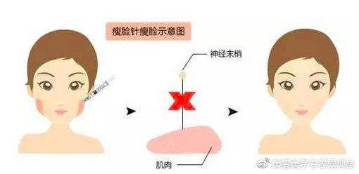瘦脸效果