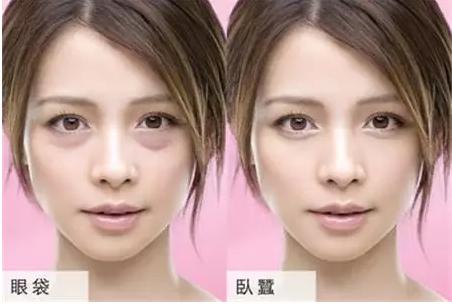 笑眼