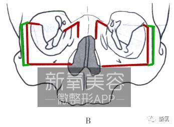 将骨头往中间移