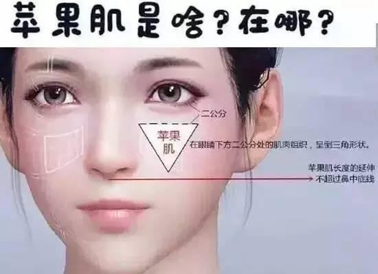 苹果肌松弛下垂