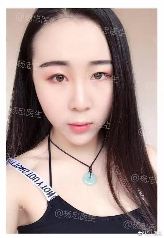 案例一