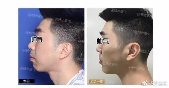 案例二