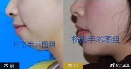 案例三