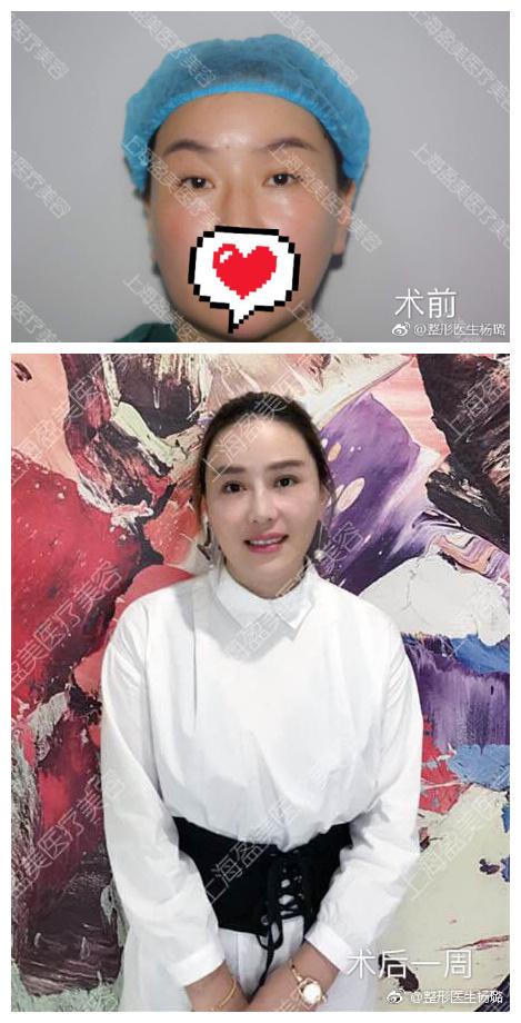 杨璐医生案例