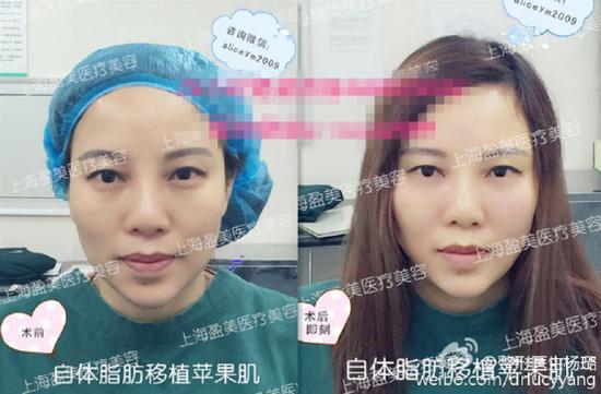 杨璐医生案例