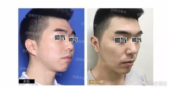 案例二