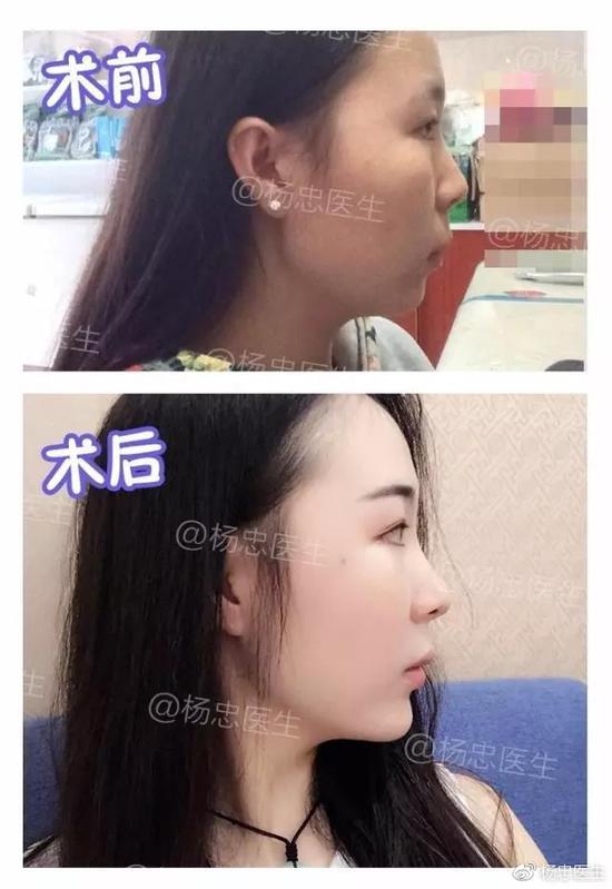 案例一