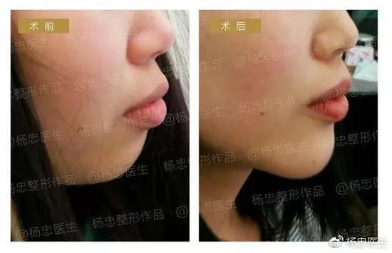 案例三