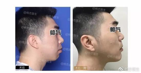 案例二