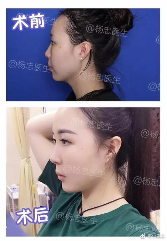 案例一