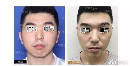 案例二