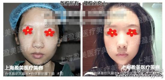 杨璐医生案例