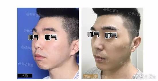 案例二