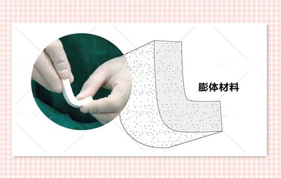 膨体材料