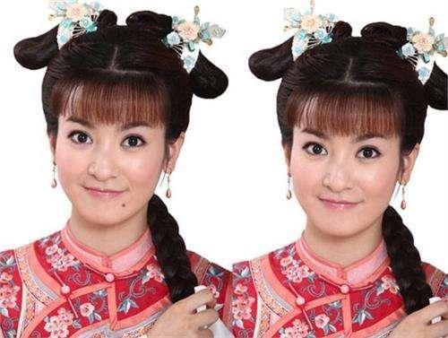 点痣