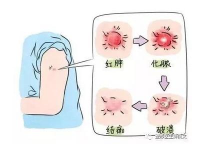 留疤