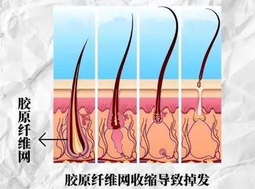 cr:视觉中国,制图于canva
