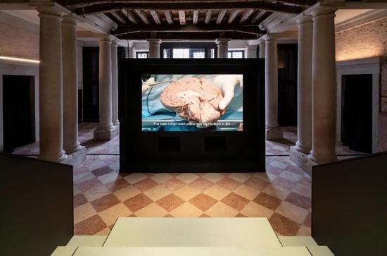 Prada 基金会在威尼斯双年展举办《人类大脑:一切始于思想》展览