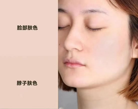 使用后,使用效果因人而异