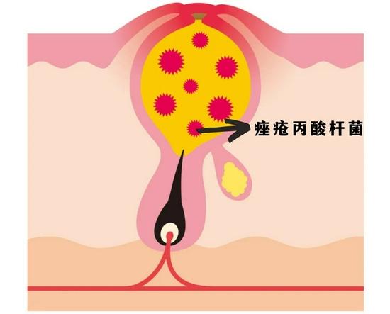 cr:图虫创意,制图canva
