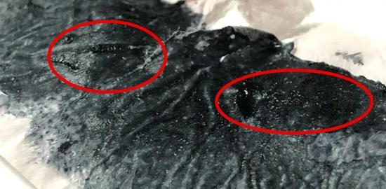 最后用水将局部清洗干净,