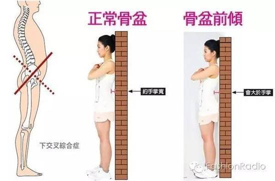 我们又把这种情况称为