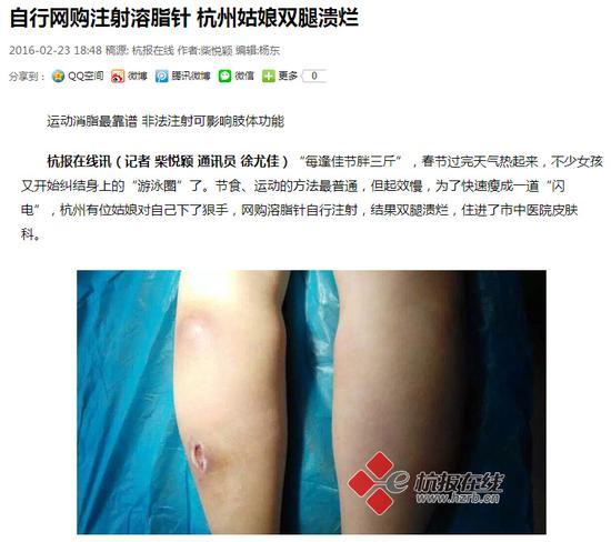 溶脂针并发症